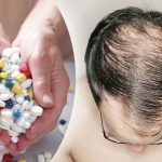How Long Does Hair Growth Tablets Take To Work